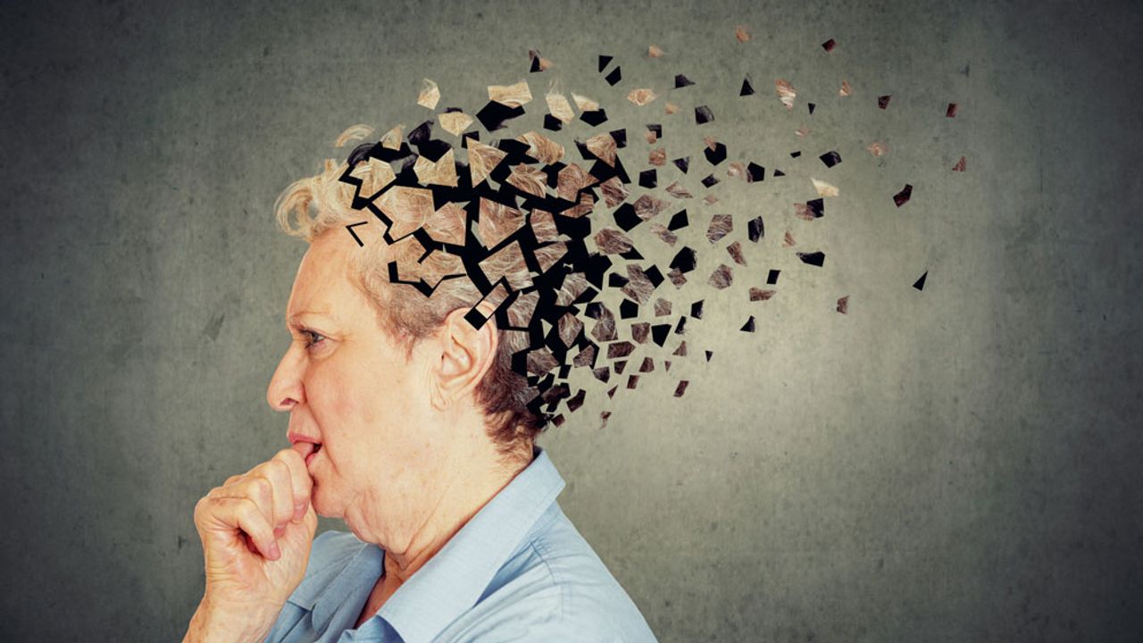 Dünyada Her 3,2 Saniyede Bir Kişi, Alzheimer Hastalığına Yakalanıyor