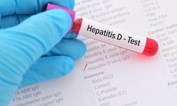 Hepatit D’ye karşı yerli tanı kiti geliştirildi