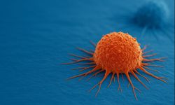 Kanser tedavisinde umut veren yeni gelişmeler