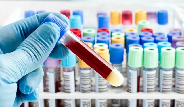 Kan testiyle hızlı ve yavaş yaşlanan organlar tespit edilebilir