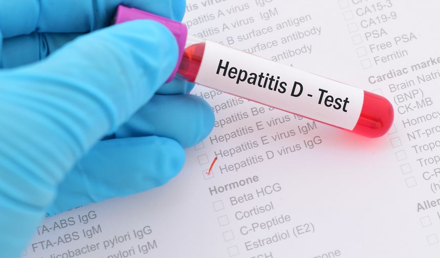 Hepatit D’ye karşı yerli tanı kiti geliştirildi