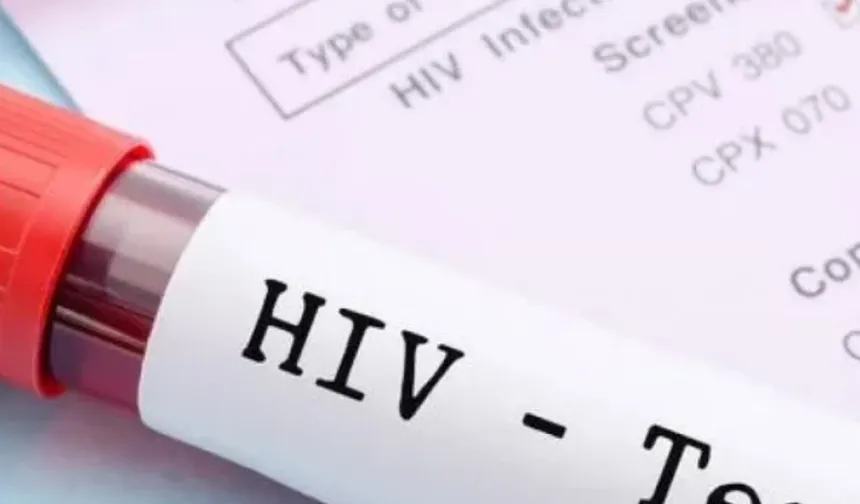 Biyologlar Derneği AIDS Günü dolayısıyla açıklama yaptı